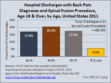 Hospital Discharges with Back Pain Diagnoses and Spinal Fusion Procedure, All Ages, by Age, United States 2012